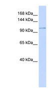ATP2B3 / PMCA3 Antibody - ATP2B3 / PMCA3 antibody Western blot of Placenta lysate. This image was taken for the unconjugated form of this product. Other forms have not been tested.