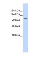 ATP2B3 / PMCA3 Antibody - ATP2B3 / PMCA3 antibody Western blot of Fetal Heart lysate. This image was taken for the unconjugated form of this product. Other forms have not been tested.