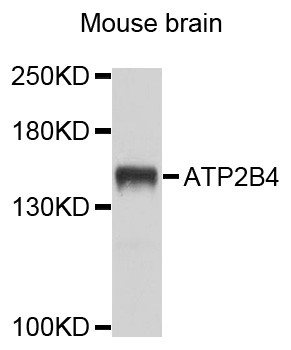 ATP2B4 / PMCA4 Antibody - Western blot analysis of extracts of mouse brain, using ATP2B4 antibody at 1:1000 dilution. The secondary antibody used was an HRP Goat Anti-Rabbit IgG (H+L) at 1:10000 dilution. Lysates were loaded 25ug per lane and 3% nonfat dry milk in TBST was used for blocking. An ECL Kit was used for detection and the exposure time was 5s.