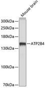 ATP2B4 / PMCA4 Antibody - Western blot analysis of extracts of mouse brain using ATP2B4 Polyclonal Antibody at dilution of 1:1000.