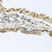 ATP2C1 Antibody - Immunohistochemistry of paraffin-embedded mouse lung tissue.