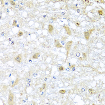 ATP2C1 Antibody - Immunohistochemistry of paraffin-embedded rat brain tissue.
