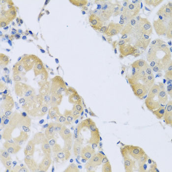 ATP2C1 Antibody - Immunohistochemistry of paraffin-embedded human stomach tissue.