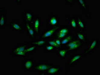 ATP2C1 Antibody - Immunofluorescent analysis of Hela cells at a dilution of 1:100 and Alexa Fluor 488-congugated AffiniPure Goat Anti-Rabbit IgG(H+L)