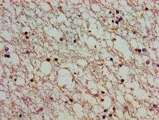 ATP2C1 Antibody - Immunohistochemistry image of paraffin-embedded human brain tissue at a dilution of 1:100