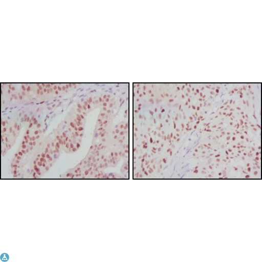 ATP2C1 Antibody - Western Blot (WB) analysis using PMR1 Monoclonal Antibody against A431 (1), HeLa (2) and HEK293 (3) cell lysate.
