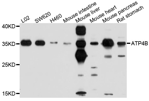 ATP4B Antibody - Western blot analysis of extracts of various cell lines, using ATP4B antibody at 1:1000 dilution. The secondary antibody used was an HRP Goat Anti-Rabbit IgG (H+L) at 1:10000 dilution. Lysates were loaded 25ug per lane and 3% nonfat dry milk in TBST was used for blocking. An ECL Kit was used for detection and the exposure time was 30s.