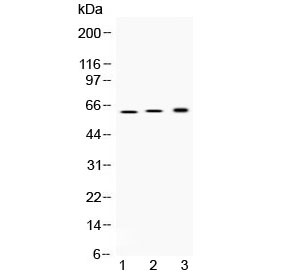 ATP4B Antibody - Western blot testing of 1) rat stomach, 2) mouse stomach and 3) human SGC-7901 (human gastric cancer) lysate with ATP4B antibody at 0.5ug/ml. Predicted molecular weight ~34 kDa (core peptide), ~52 kDa (beta subunit precursor), 60-80 kDa (glycosylated form).