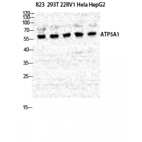 ATP5A1 / ATP Synthase Alpha Antibody - Western blot of ATP5A antibody