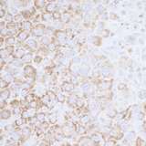ATP5A1 / ATP Synthase Alpha Antibody - Detection of mouse ATP5A1 by immunohistochemistry. Sample: FFPE section of mouse renal cell carcinoma. Antibody: Affinity purified rabbit anti-ATP5A1 used at a dilution of 1:5,000 (0.2µg/ml). Detection: DAB