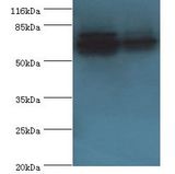 ATP5A1 / ATP Synthase Alpha Antibody - Western blot. All lanes: ATP5A1 antibody at 2 ug/ml. Lane 1: HeLa whole cell lysate. Lane 2: COLO205 whole cell lysate. Secondary antibody: goat polyclonal to rabbit at 1:10000 dilution. Predicted band size: 60 kDa. Observed band size: 60 kDa.  This image was taken for the unconjugated form of this product. Other forms have not been tested.