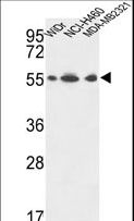 ATP5A1 / ATP Synthase Alpha Antibody - ATP5A1 Antibody western blot of WiDr,NCI-H460,MDA-MB231 cell line lysates (35 ug/lane). The ATP5A1 antibody detected the ATP5A1 protein (arrow).