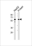 ATP5A1 / ATP Synthase Alpha Antibody - All lanes : Anti-ATP5A1 Antibody at 1:1000 dilution Lane 1: HepG2 whole cell lysates Lane 2: H.heart tissue lysates Lysates/proteins at 20 ug per lane. Secondary Goat Anti-Rabbit IgG, (H+L),Peroxidase conjugated at 1/10000 dilution Predicted band size : 60 kDa Blocking/Dilution buffer: 5% NFDM/TBST.