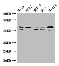 ATP5A1 / ATP Synthase Alpha Antibody - Positive WB detected in:Hela whole cell lysate,K562 whole cell lysate,MCF-7 whole cell lysate,PC3 whole cell lysate,Mouse heart tissue;All lanes: ATP5A1 antibody at 2.5ug/ml;Secondary;Goat polyclonal to rabbit IgG at 1/50000 dilution;Predicted band size: 60,55,58 kDa;Observed band size: 60,58 kDa;