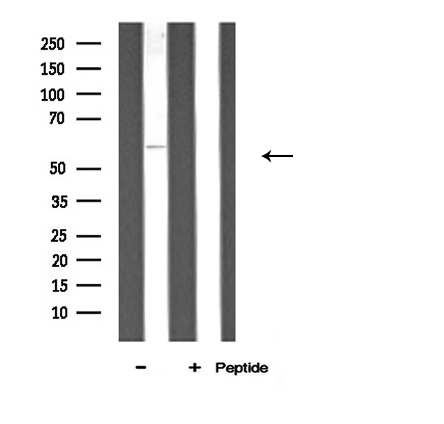 ATP5A1 / ATP Synthase Alpha Antibody - Western blot analysis of ATP5A1 expression in mouse brain lysate