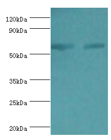 ATP5B / ATP Synthase Beta Antibody - Western blot. All lanes: ATP synthase subunit beta, mitochondrial antibody at 9 ug/ml. Lane 1: HeLa whole cell lysate. Lane 2: HepG2 whole cell lysate. Secondary antibody: Goat polyclonal to rabbit at 1:10000 dilution. Predicted band size: 57 kDa. Observed band size: 57 kDa.