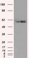 ATP5B / ATP Synthase Beta Antibody - HEK293T cells were transfected with the pCMV6-ENTRY control (Left lane) or pCMV6-ENTRY ATP5B (Right lane) cDNA for 48 hrs and lysed. Equivalent amounts of cell lysates (5 ug per lane) were separated by SDS-PAGE and immunoblotted with anti-ATP5B.