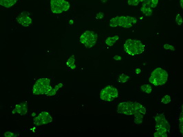 ATP5B / ATP Synthase Beta Antibody - Immunofluorescent staining of HepG2 cells using anti-ATP5B mouse monoclonal antibody.