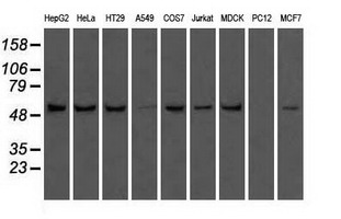 ATP5B / ATP Synthase Beta Antibody - Western blot analysis of extracts (35ug) from 9 different cell lines by using anti-ATP5B monoclonal antibody.