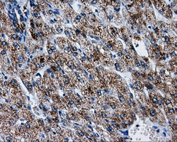ATP5B / ATP Synthase Beta Antibody - Immunohistochemical staining of paraffin-embedded liver tissue using anti-ATP5B mouse monoclonal antibody. (Dilution 1:50).