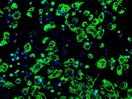 ATP5B / ATP Synthase Beta Antibody - Anti-ATP5B mouse monoclonal antibody  immunofluorescent staining of COS7 cells transiently transfected by pCMV6-ENTRY ATP5B.
