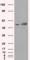 ATP5B / ATP Synthase Beta Antibody - HEK293T cells were transfected with the pCMV6-ENTRY control (Left lane) or pCMV6-ENTRY ATP5B (Right lane) cDNA for 48 hrs and lysed. Equivalent amounts of cell lysates (5 ug per lane) were separated by SDS-PAGE and immunoblotted with anti-ATP5B.