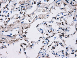 ATP5B / ATP Synthase Beta Antibody - IHC of paraffin-embedded lung tissue using anti-ATP5B mouse monoclonal antibody. (Dilution 1:50).
