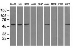 ATP5B / ATP Synthase Beta Antibody - Western blot analysis of extracts (35ug) from 9 different cell lines by using anti-ATP5B monoclonal antibody.