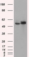 ATP5B / ATP Synthase Beta Antibody - HEK293T cells were transfected with the pCMV6-ENTRY control (Left lane) or pCMV6-ENTRY ATP5B (Right lane) cDNA for 48 hrs and lysed. Equivalent amounts of cell lysates (5 ug per lane) were separated by SDS-PAGE and immunoblotted with anti-ATP5B.