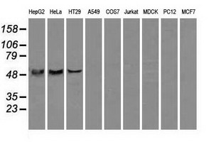 ATP5B / ATP Synthase Beta Antibody - Western blot of extracts (35 ug) from 9 different cell lines by using anti-ATP5B monoclonal antibody.