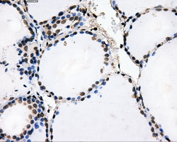 ATP5B / ATP Synthase Beta Antibody - IHC of paraffin-embedded thyroid tissue using anti-ATP5B mouse monoclonal antibody. (Dilution 1:50).