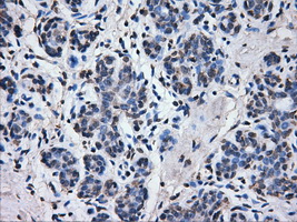 ATP5B / ATP Synthase Beta Antibody - IHC of paraffin-embedded breast tissue using anti-ATP5B mouse monoclonal antibody. (Dilution 1:50).