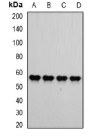 ATP5B / ATP Synthase Beta Antibody - Western blot analysis of ATP5B expression in SW620 (A); HepG2 (B); mouse kidney (C); mouse brain (D) whole cell lysates.