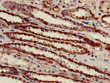 ATP5B / ATP Synthase Beta Antibody - Immunohistochemistry of paraffin-embedded human kidney tissue at dilution of 1:100