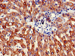 ATP5B / ATP Synthase Beta Antibody - Immunohistochemistry of paraffin-embedded human liver tissue at dilution of 1:100