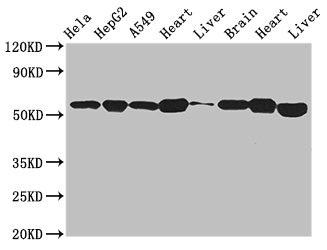 ATP5B / ATP Synthase Beta Antibody - Western Blot Positive WB detected in:Hela whole cell lysate,HepG2 whole cell lysate,A549 whole cell lysate,Mouse heart tissue,Mouse liver tissue,Mouse brain tissue,Rat heart tissue,Mouse liver tissue All Lanes:ATP5B antibody at 2.7µg/ml Secondary Goat polyclonal to rabbit IgG at 1/50000 dilution Predicted band size: 57 KDa Observed band size: 57 KDa