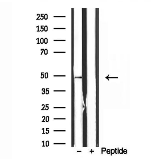 ATP5B / ATP Synthase Beta Antibody - Western blot analysis of extracts of human heart tissue using ATPB antibody.