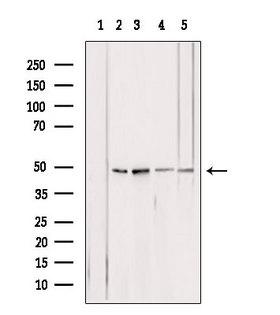 ATP5B / ATP Synthase Beta Antibody - Western blot analysis of extracts of various samples using ATPB antibody. Lane 1: HepG2 treated with blocking peptide. Lane 2: HepG2; Lane 3: 293; Lane 4: mouse brain; Lane 5: rat muscle;