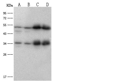 ATP5B / ATP Synthase Beta Antibody - Anti-ATP5B rabbit polyclonal antibody at 1:500 dilution. Lane A: HeLa Whole Cell Lysate. Lane B: HepG2 Whole Cell Lysate. Lane C: Mouse heart tissue lysate. Lane D: Rat heart tissue lysate. Lysates/proteins at 30 ug per lane. Secondary: Goat Anti-Rabbit IgG (H+L)/HRP at 1/10000 dilution. Developed using the ECL technique. Performed under reducing conditions. Predicted band size: 56 kDa. Observed band size: 54 kDa. (We are unsure as to the identity of these extra bands.)