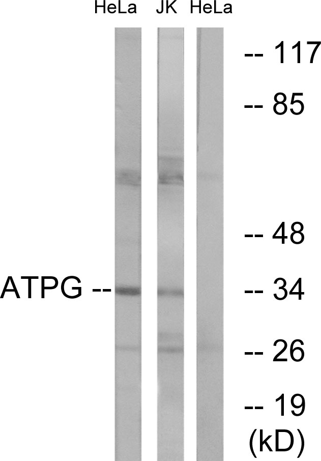 ATP5C1 Antibody - Western blot analysis of lysates from HeLa cells and Jurkat cells, using ATPG Antibody. The lane on the right is blocked with the synthesized peptide.