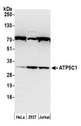 ATP5C1 Antibody - Detection of human ATP5C1 by western blot. Samples: Whole cell lysate (50 µg) from HeLa, HEK293T, and Jurkat cells. Antibody: Affinity purified rabbit anti-ATP5C1 antibody used for WB at 0.1 µg/ml. Detection: Chemiluminescence with an exposure time of 30 seconds.