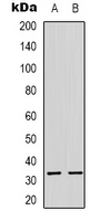 ATP5C1 Antibody - Western blot analysis of ATP5C1 expression in HeLa (A); HepG2 (B) whole cell lysates.