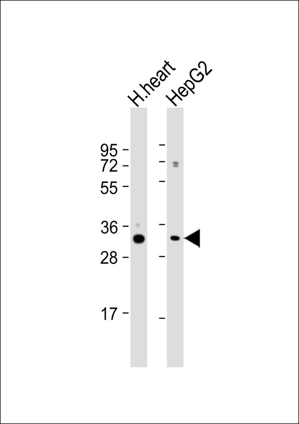 ATP5C1 Antibody - All lanes: Anti-ATP5C1 Antibody at 1:1000 dilution. Lane 1: human heart lysate. Lane 2: HepG2 whole cell lysate Lysates/proteins at 20 ug per lane. Secondary Goat Anti-Rabbit IgG, (H+L), Peroxidase conjugated at 1:10000 dilution. Predicted band size: 33 kDa. Blocking/Dilution buffer: 5% NFDM/TBST.