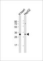 ATP5C1 Antibody - All lanes: Anti-ATP5C1 Antibody at 1:1000 dilution. Lane 1: human heart lysate. Lane 2: HepG2 whole cell lysate Lysates/proteins at 20 ug per lane. Secondary Goat Anti-Rabbit IgG, (H+L), Peroxidase conjugated at 1:10000 dilution. Predicted band size: 33 kDa. Blocking/Dilution buffer: 5% NFDM/TBST.