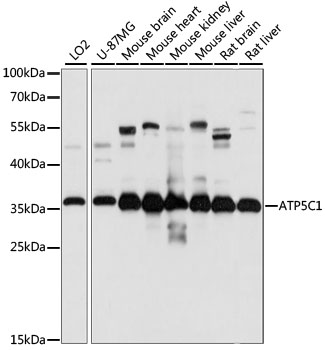 ATP5C1 Antibody - Western blot analysis of extracts of various cell lines, using ATP5C1 antibody at 1:1000 dilution. The secondary antibody used was an HRP Goat Anti-Rabbit IgG (H+L) at 1:10000 dilution. Lysates were loaded 25ug per lane and 3% nonfat dry milk in TBST was used for blocking. An ECL Kit was used for detection and the exposure time was 5S.