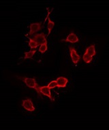 ATP5C1 Antibody - Staining HeLa cells by IF/ICC. The samples were fixed with PFA and permeabilized in 0.1% Triton X-100, then blocked in 10% serum for 45 min at 25°C. The primary antibody was diluted at 1:200 and incubated with the sample for 1 hour at 37°C. An Alexa Fluor 594 conjugated goat anti-rabbit IgG (H+L) Ab, diluted at 1/600, was used as the secondary antibody.