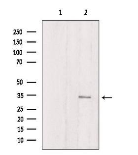 ATP5C1 Antibody - Western blot analysis of extracts of mouse brain tissue using ATPG antibody. Lane 1 was treated with the antigen-specific peptide.