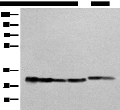 ATP5C1 Antibody - Western blot analysis of Human heart tissue A549 231 Jurkat HEPG2 and Hela cell lysates  using ATP5C1 Polyclonal Antibody at dilution of 1:1000
