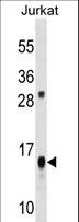 ATP5D Antibody - ATP5D Antibody western blot of Jurkat cell line lysates (35 ug/lane). The ATP5D antibody detected the ATP5D protein (arrow).