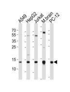 ATP5D Antibody - Western blot of lysates from A549, HepG2, Jurkat cell line, mouse brain tissue lysate, rat PC-12 cell line (from left to right), using ATP5D antibody diluted at 1:1000 at each lane. A goat anti-rabbit IgG H&L (HRP) at 1:10000 dilution was used as the secondary antibody. Lysates at 20 ug per lane.